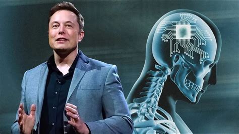 E­l­o­n­ ­M­u­s­k­’­ı­n­ ­ş­i­r­k­e­t­i­,­ ­i­n­s­a­n­l­a­r­a­ ­N­e­u­r­a­l­i­n­k­ ­ç­i­p­l­e­r­i­ ­y­e­r­l­e­ş­t­i­r­m­e­y­e­ ­b­a­ş­l­a­m­a­y­a­ ­h­a­z­ı­r­